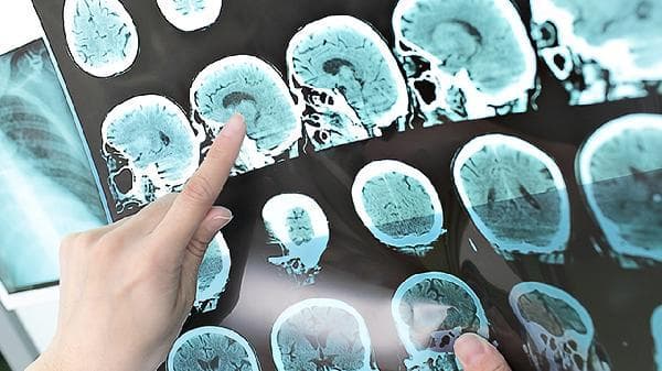 精神不集中、记忆力差？这些改善方法请收好