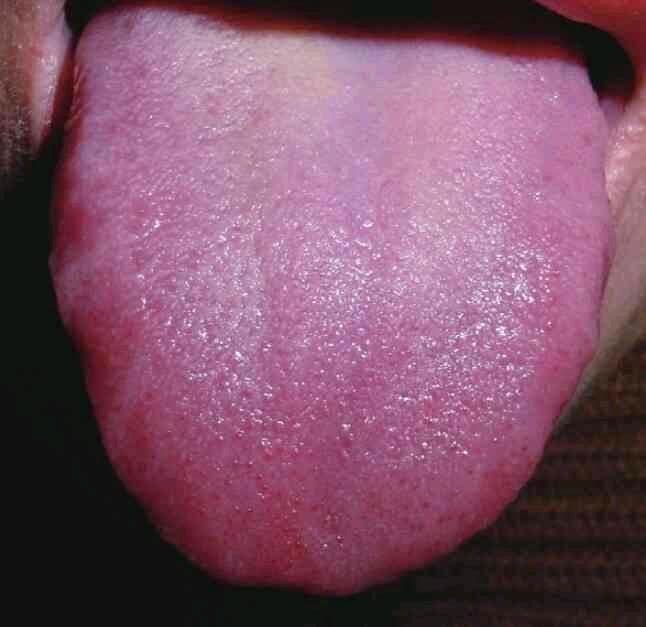 六经病证与舌象