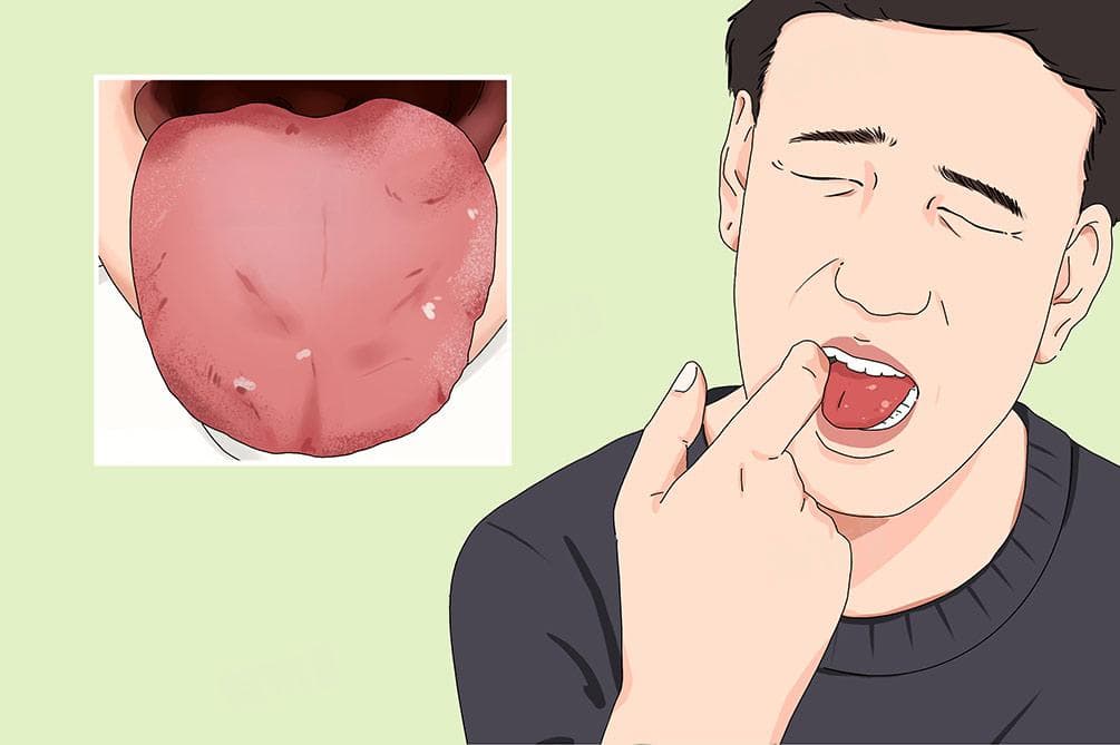 舌头干燥是什么原因