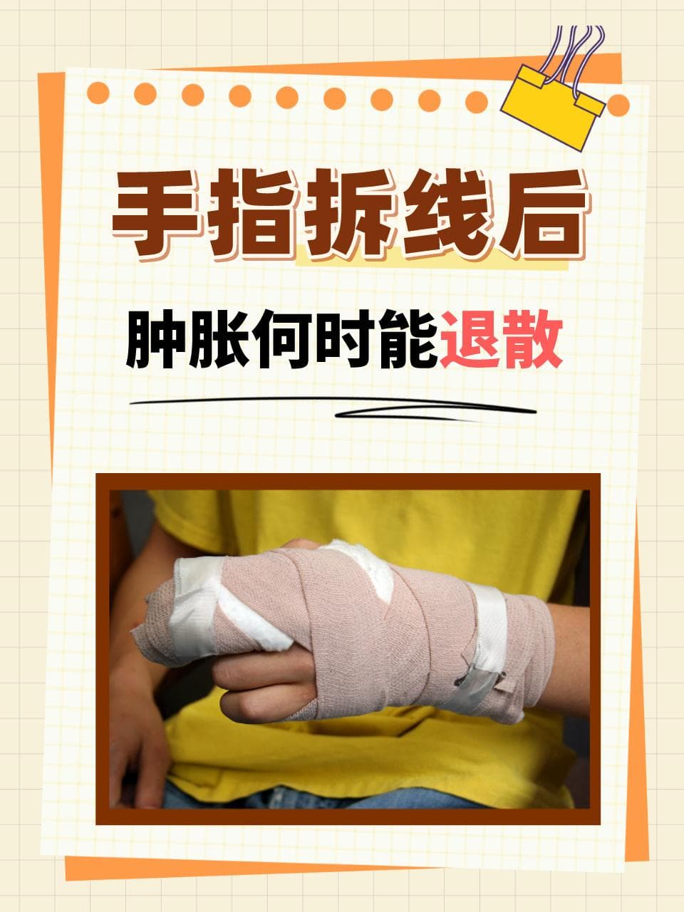手指拆线后，肿胀何时能退散