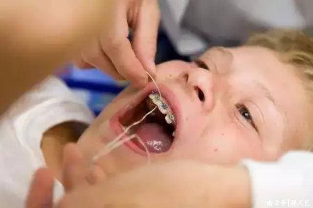 孩子多大能“矫牙”？医生：把握“早矫期”很重要