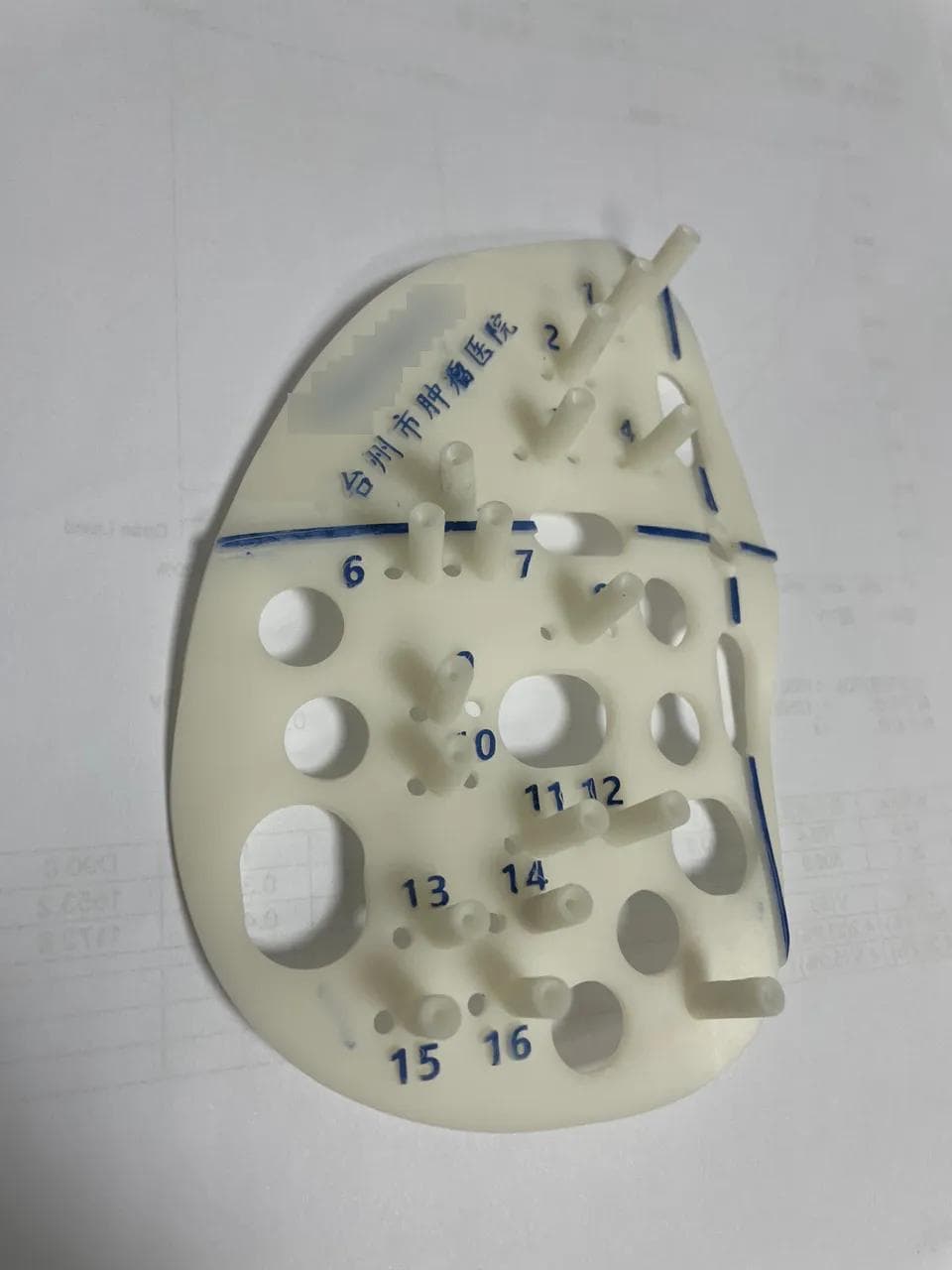 精准击溃肿瘤新疗法：3D打印模板辅助CT引导放射性粒子植入术