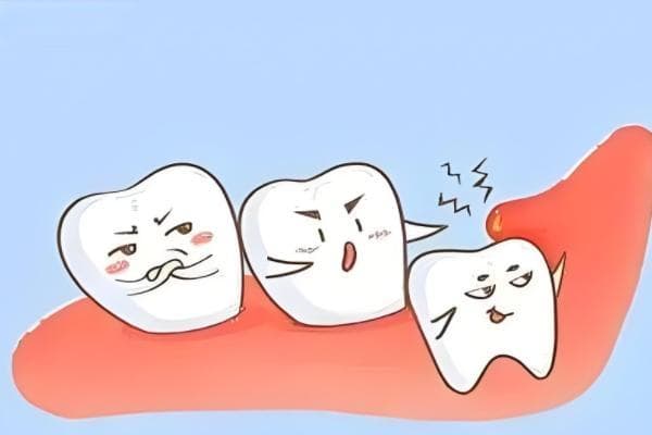 为什么牙疼的时候不能拔牙？