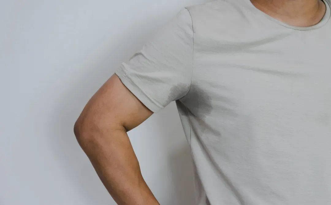 腋下多汗、异味，是否就意味着患有狐臭？有没有不手术解决的办法？