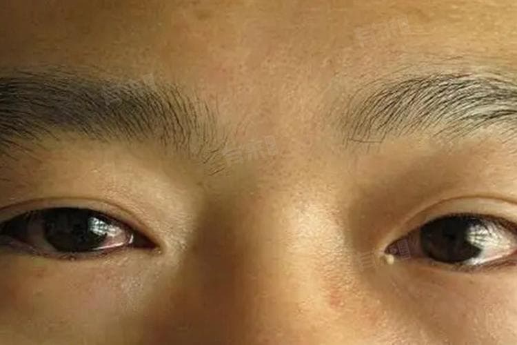 为什么会有眼屎？这些原因你可能从未想过