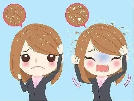 脂溢性皮炎快走开，清爽头皮还回来