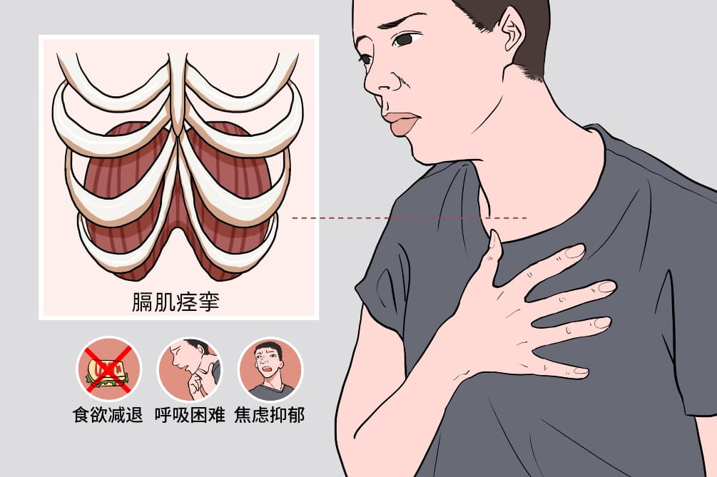 顽固性呃逆