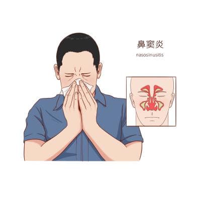 鼻窦炎是如何影响生活的？