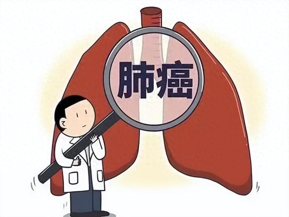 为何肺癌早期很难发现？远离风险因素，出现这些症状，及时就医