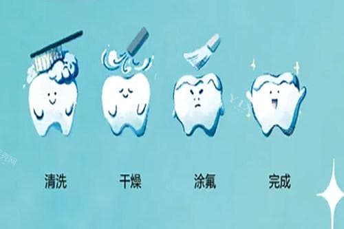 涂氟哪个牌子好？六款涂氟剂品牌特点及选择指南