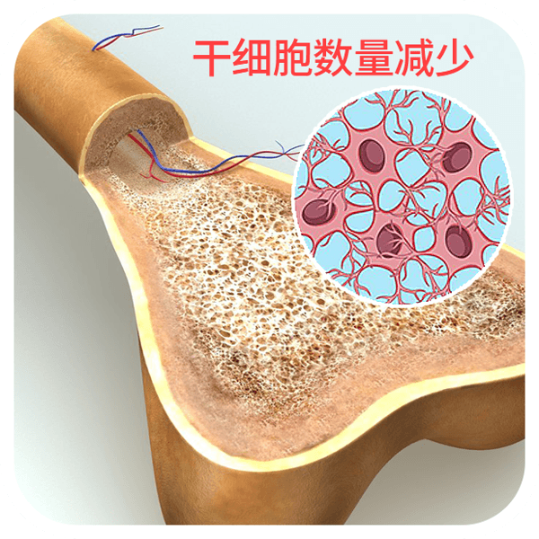 怎样增加骨密度5个小方法