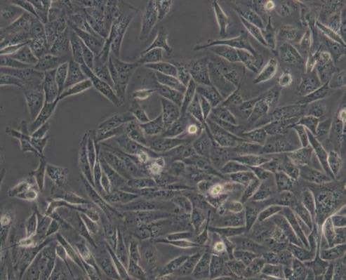 MDA-MB-231细胞系：培养方法与应用研究