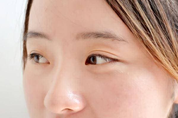 皮肤暗黄的5大原因及7个改善方法