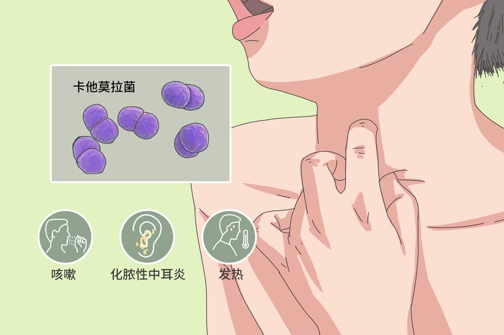 卡他莫拉菌感染：症状、诊断与治疗全解析