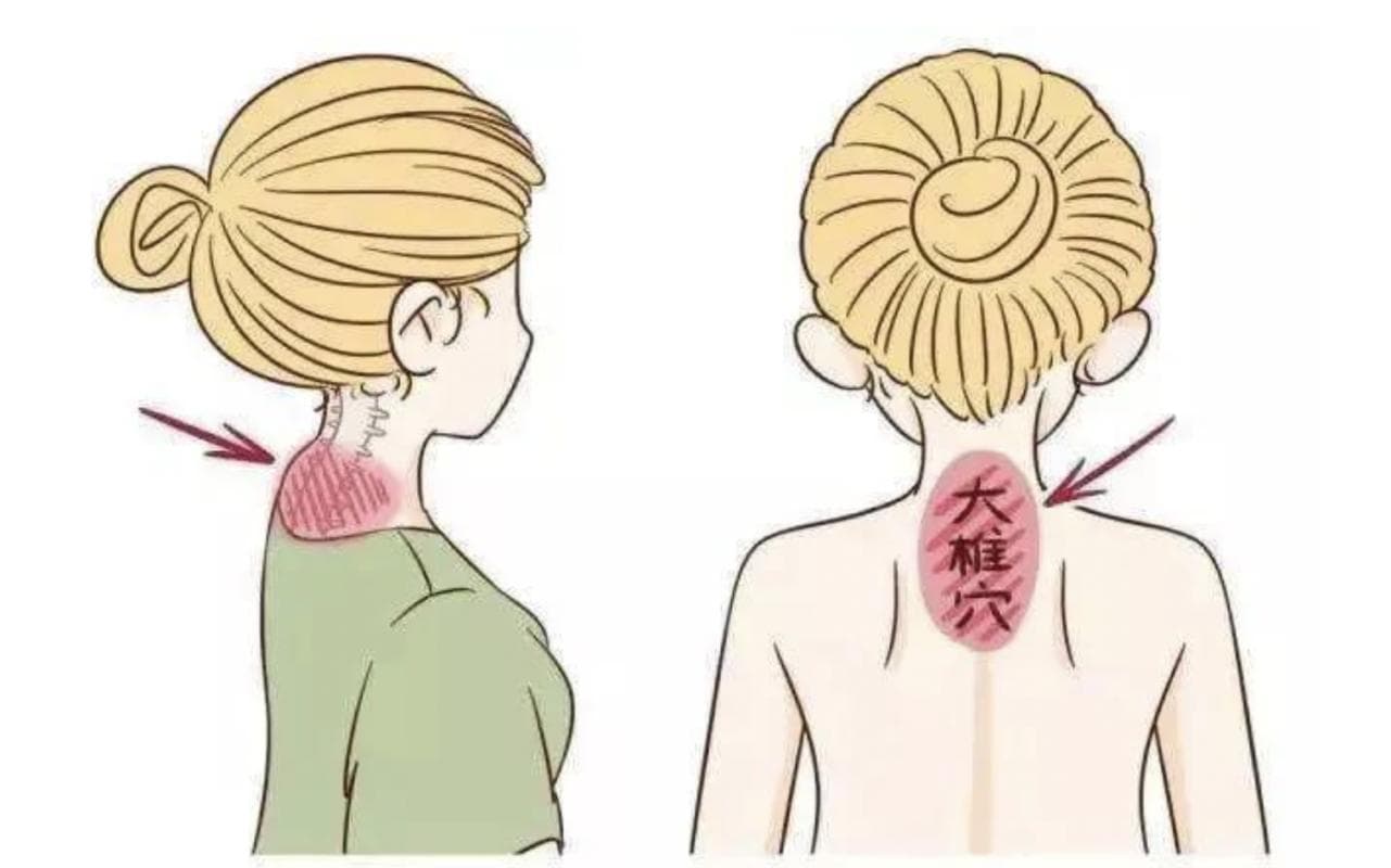 富贵包令你虎背熊腰？详解中医师如何治疗富贵包
