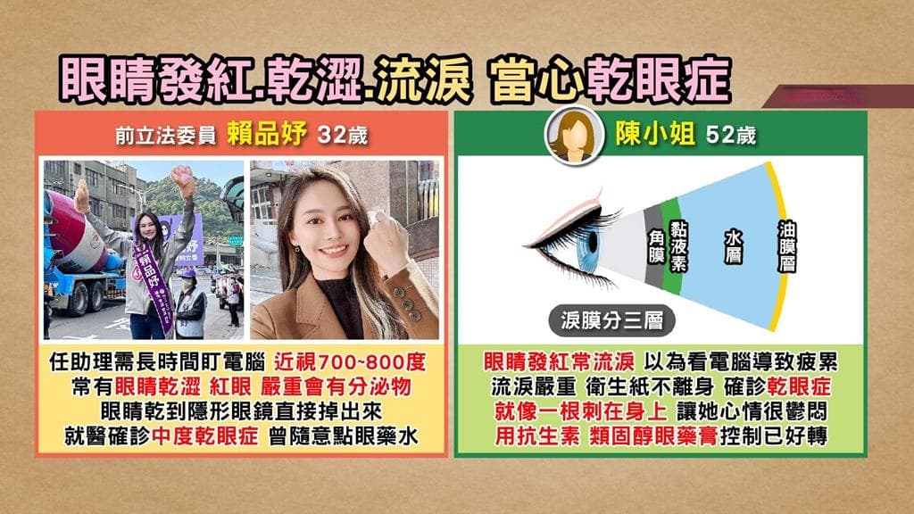 賴品妤也中！醫揭「4種人」是乾眼症高危險群3大營養素保水護眼