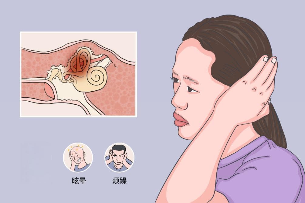 听觉过敏：症状、诊断与治疗全解析