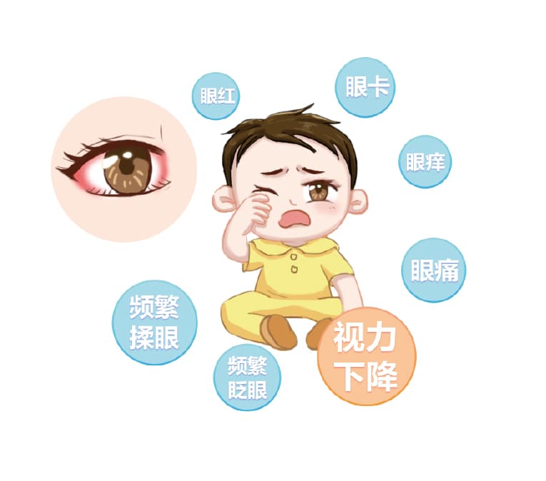 异物入眼该咋办？千万别揉！正确处理方法看这里