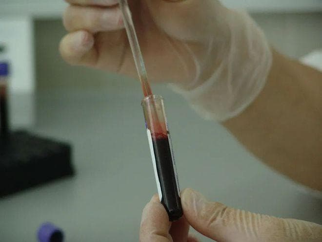 一文读懂血常规：15项关键指标解读与疾病诊断应用