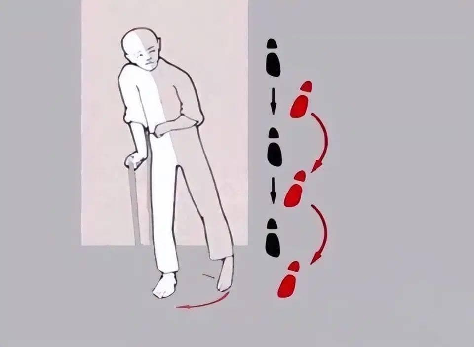 中风偏瘫软瘫期康复：如何实现个性化的精准康复训练？