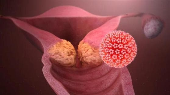 泡温泉、游泳会感染HPV？别慌，这里有你的防护指南