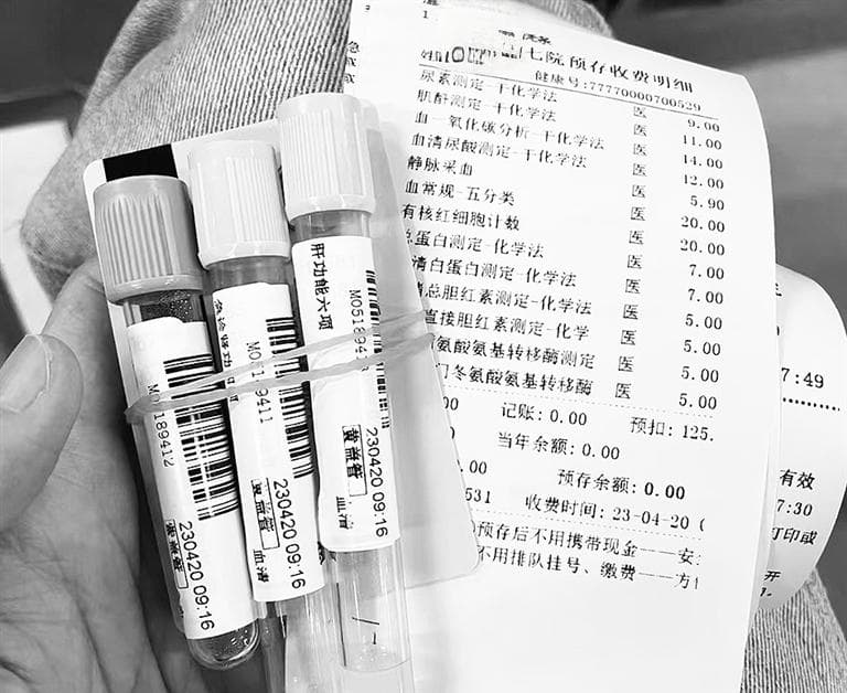 定期监测肝功能 预防药物性肝损伤
