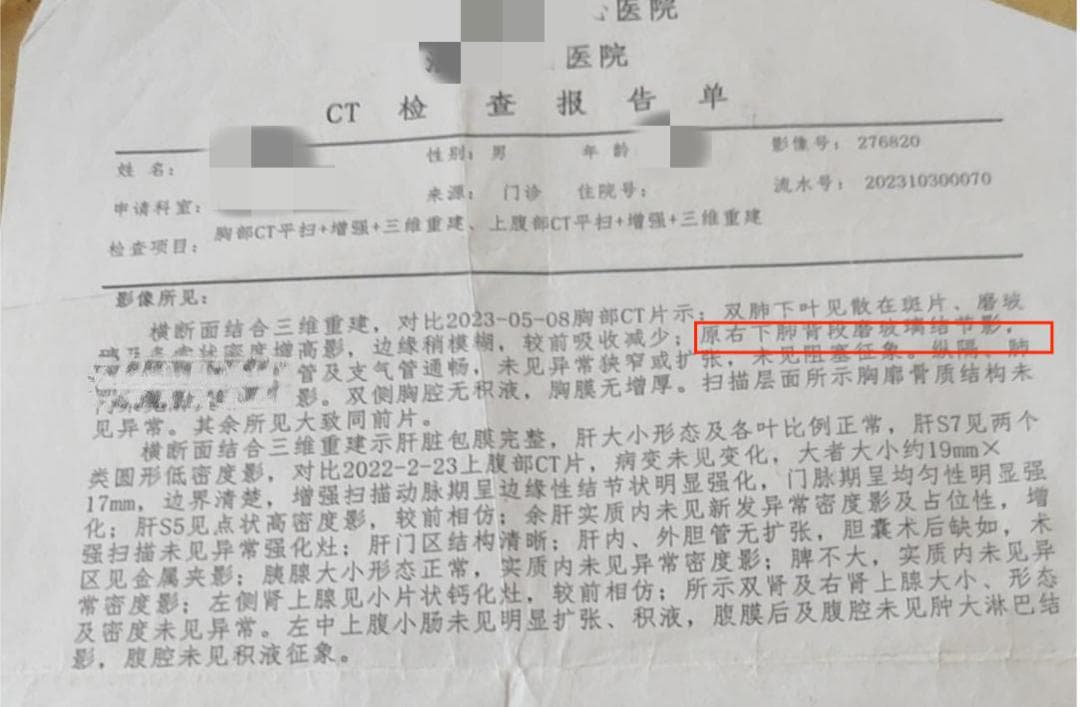 让肺结节消失，靠的就是这张省名医独创药方， 错过真是太可惜了！