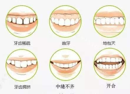错颌畸形矫正：多因素综合考量与个性化治疗方案的制定