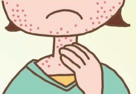宝宝过敏与湿疹的区别：一��钟快速识别指南