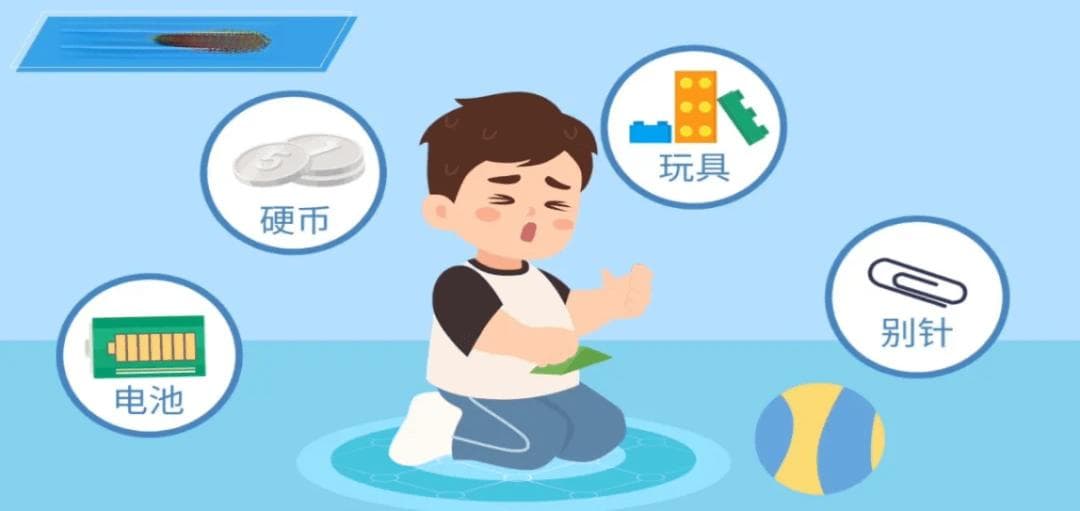 谨防“祸从口入”——不可忽视的食管异物