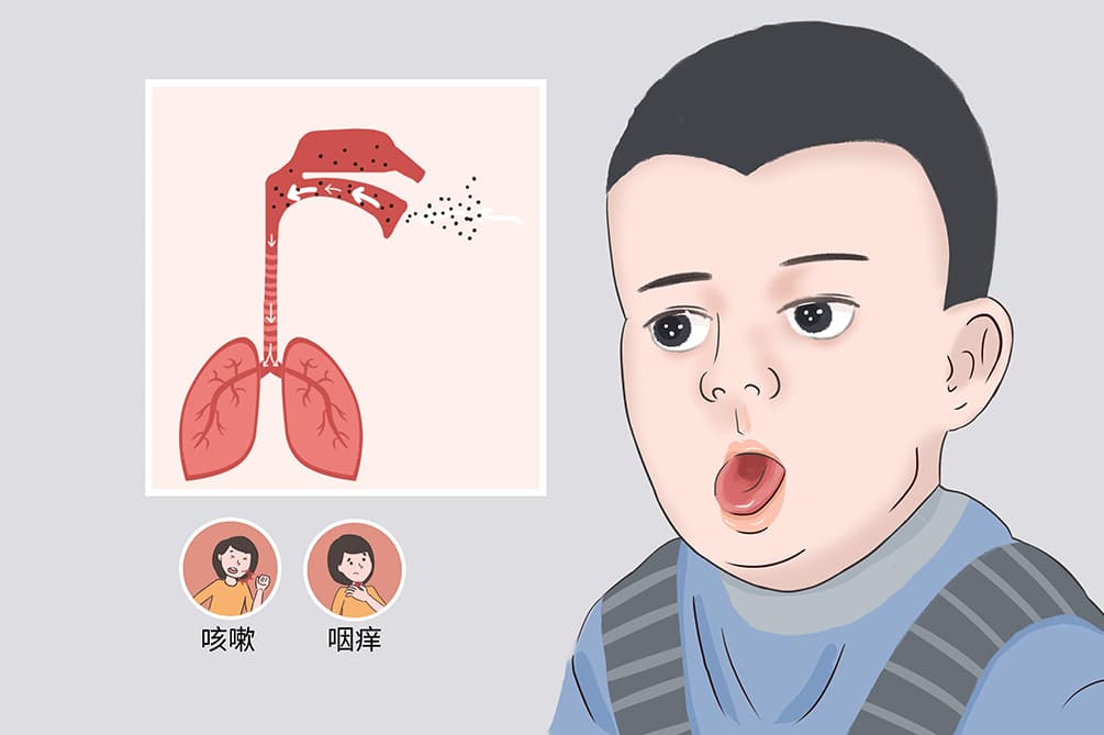 怎样判断小孩得了支原体咳嗽