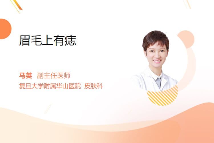 眉毛上有痣