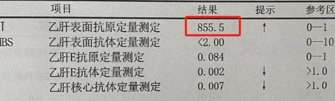 干扰素治疗乙肝，转阴有望？看你是否符合这3大条件！