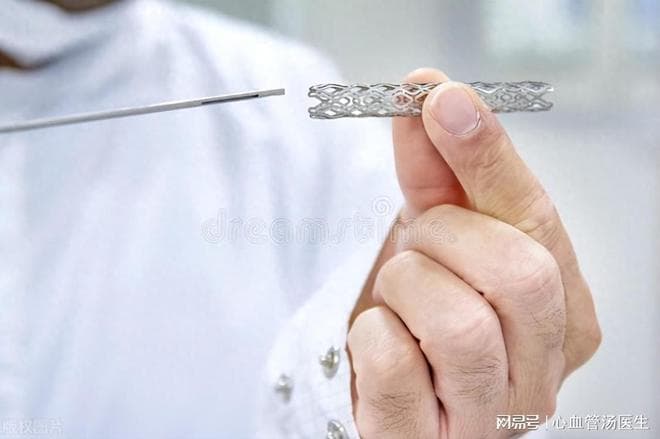 心脏支架做完“人就废了”？支架逐渐被淘汰吗？5个问题要清楚