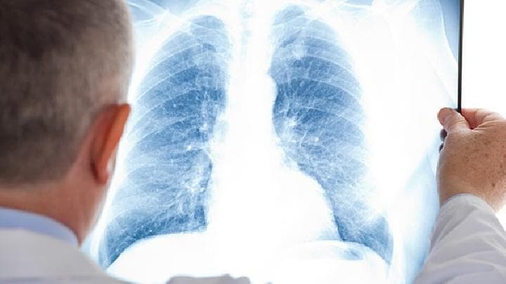 抽烟的人可以做哪些肺部检查? 抽烟人体检肺部检查项目大全