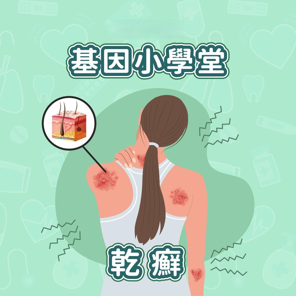 认识没有感染性但具有遗传性的“银屑病”