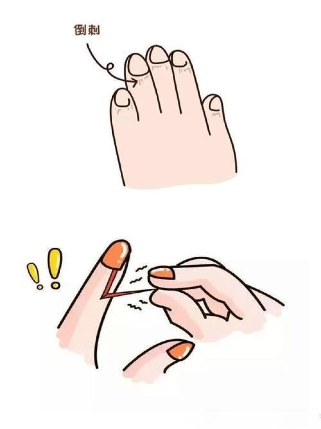 起倒刺是因为缺维生素吗？真正的原因其实是这些！