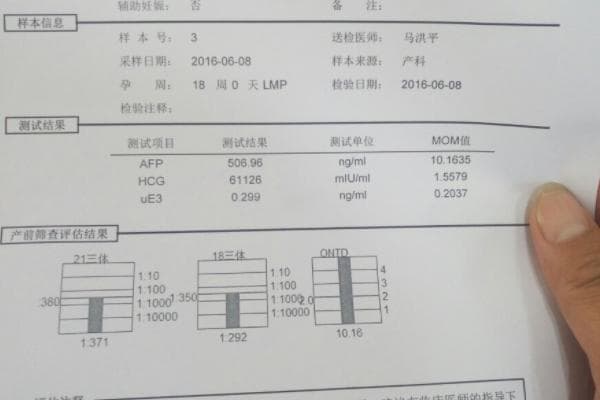 早唐和中唐四大区别揭晓，时间、方式样样不同