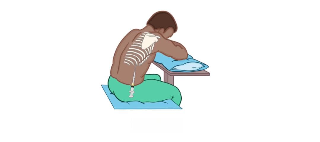 常见肺部疾病——气胸（Pneumothorax）