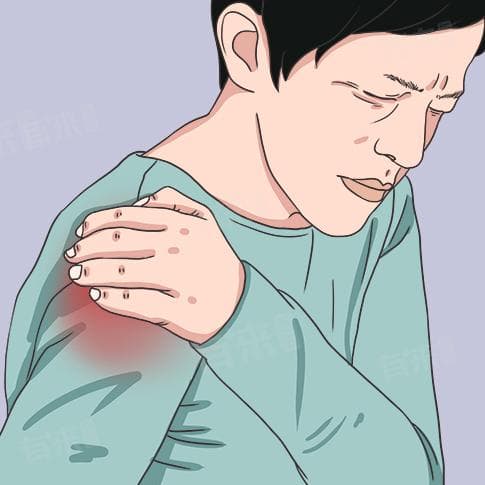 肩关节疼痛的科学治疗方法及预后分析