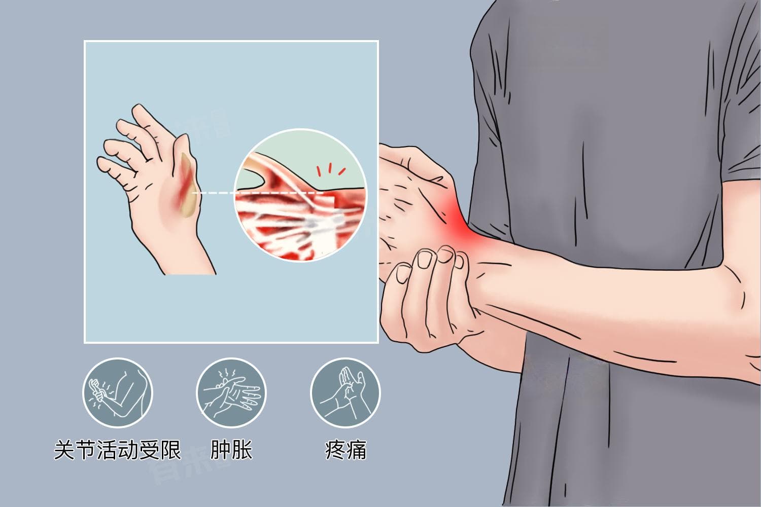 手腕关节痛什么原因