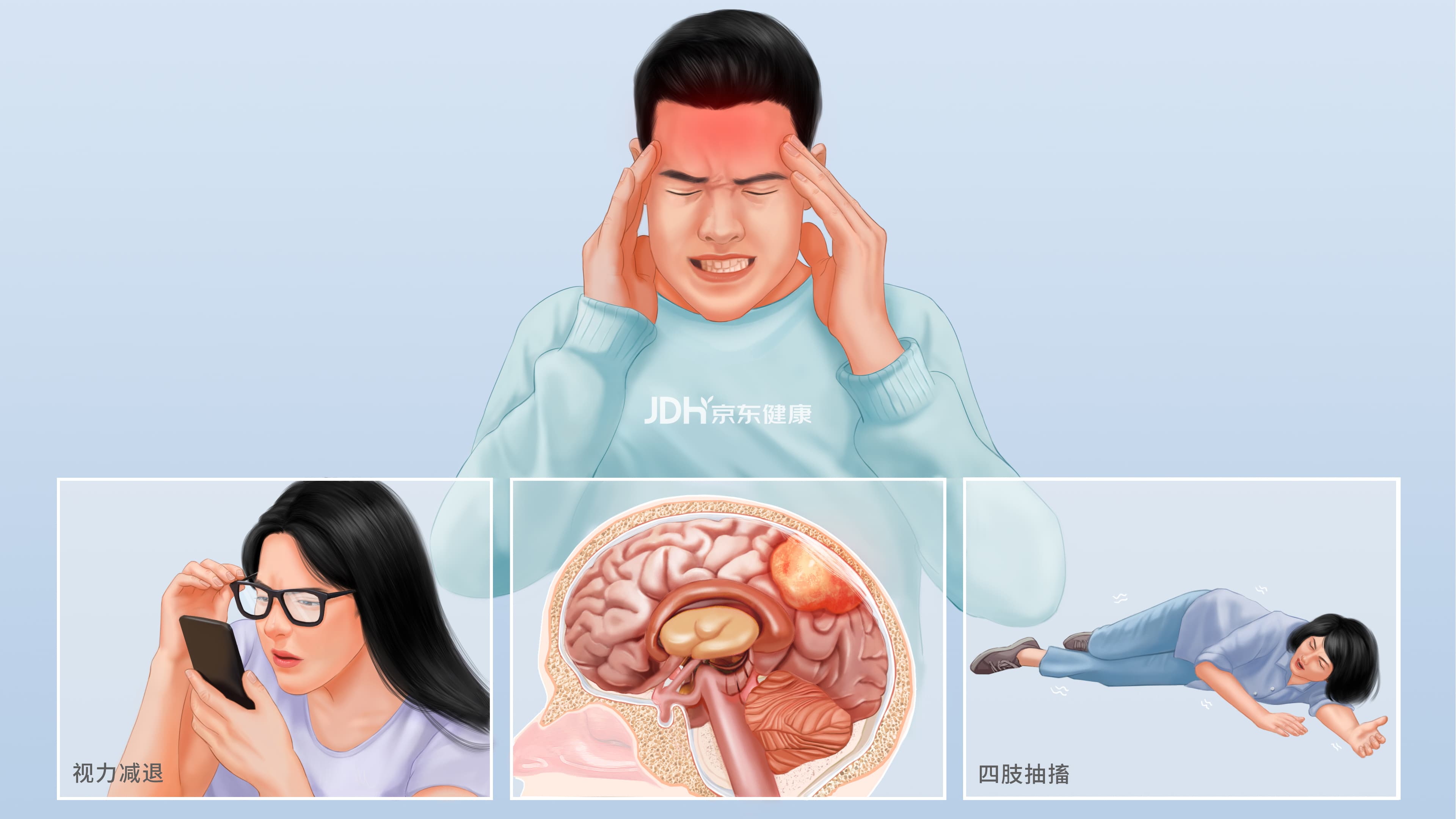 脑膜瘤：症状、诊断与治疗全解析
