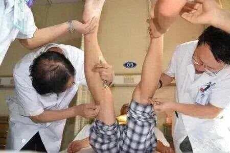 针灸配伍规律：不同穴位的协同作用