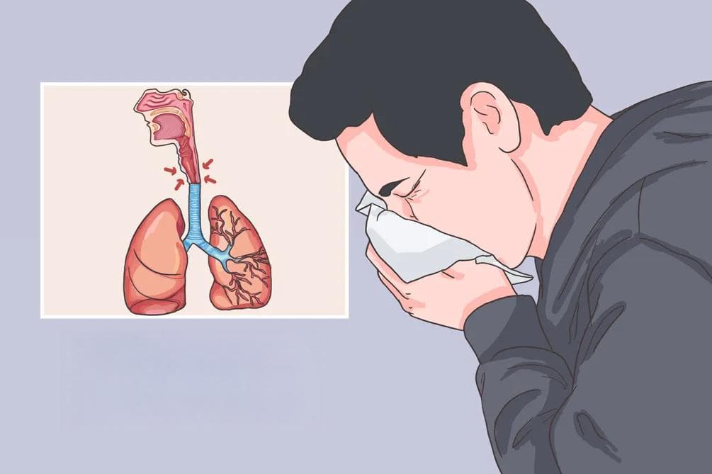 呼吸道狭窄：病因、症状、诊断与治疗全解析