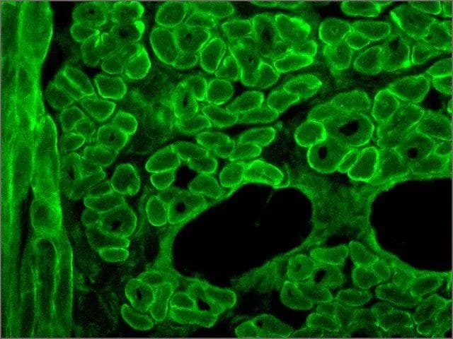 冰冻切片免疫组化（IHC-Fr）技术详解