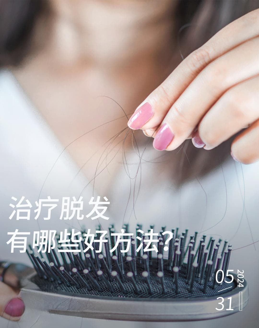 5种“脱发治疗方式”大PK，哪一种省钱又有效？