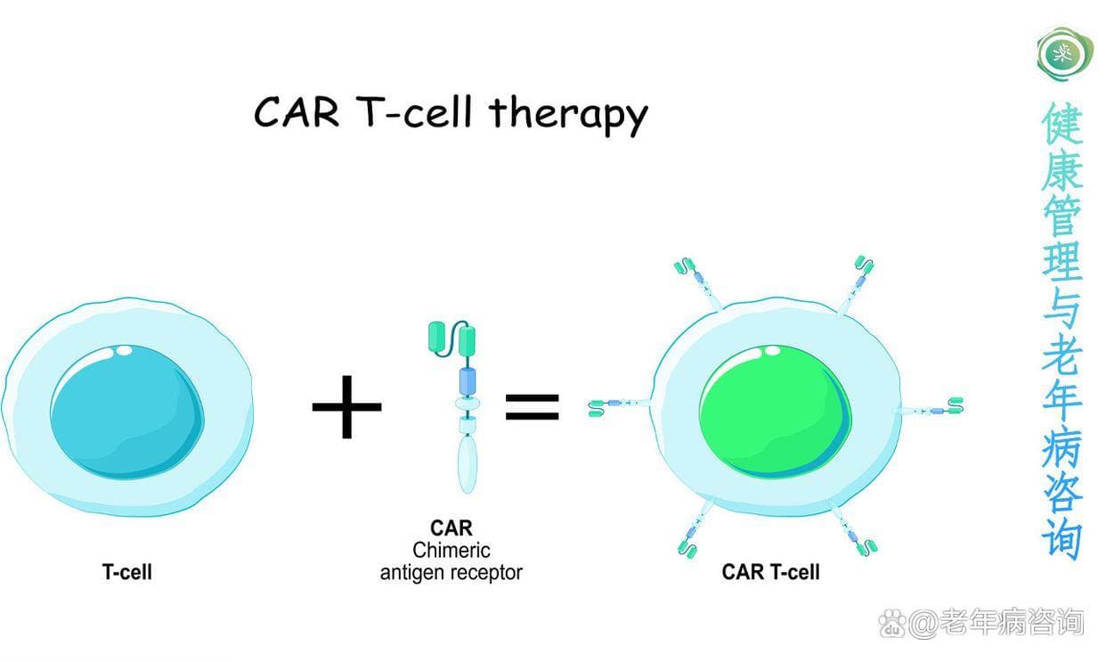 CAR-T细胞疗法：多发性骨髓瘤治疗的新曙光？