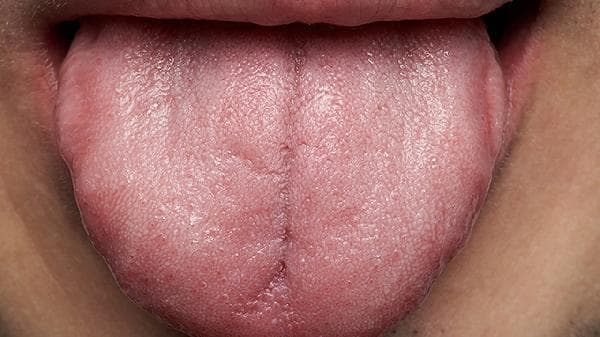 口臭、舌苔白、口苦的可能原因及应对方法