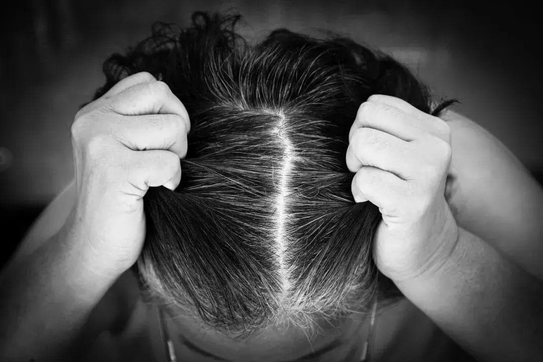 白发不只是衰老：不同位置白发对应的身体预警与调理方案