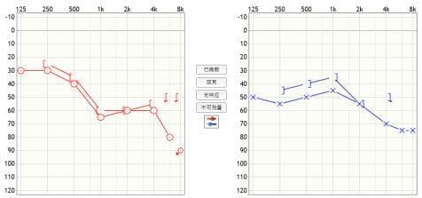 全国爱耳日 | 老年性聋和助听器：科学应对听力损失，提升生活质量
